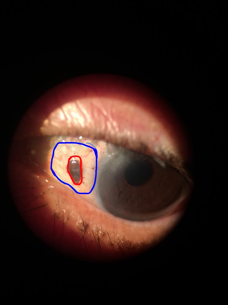 Marked Image